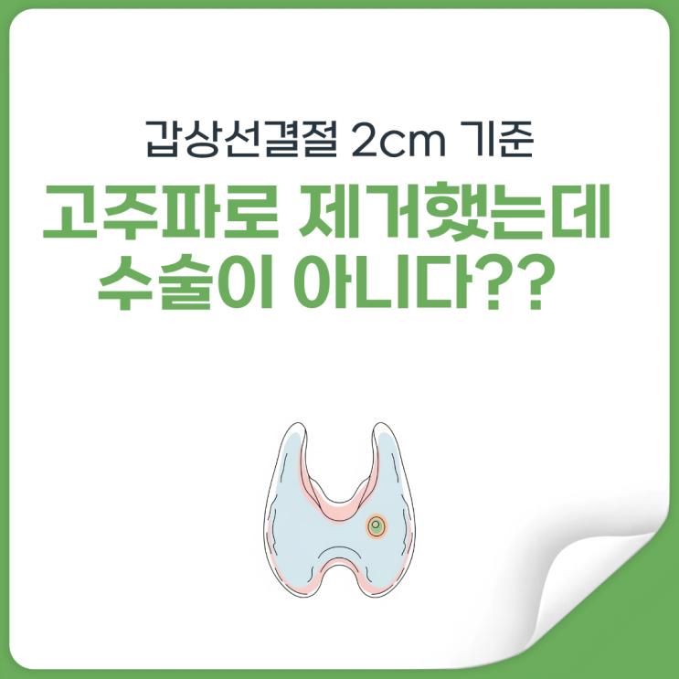  갑상선결절 고주파술, 수술인데도 보험금 갈리는 이유