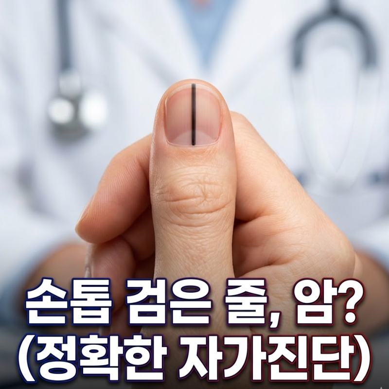 손톱 검은 세로줄, 흑색종 증상일까? 원인 및 자가진단법 (전문가 가이드)