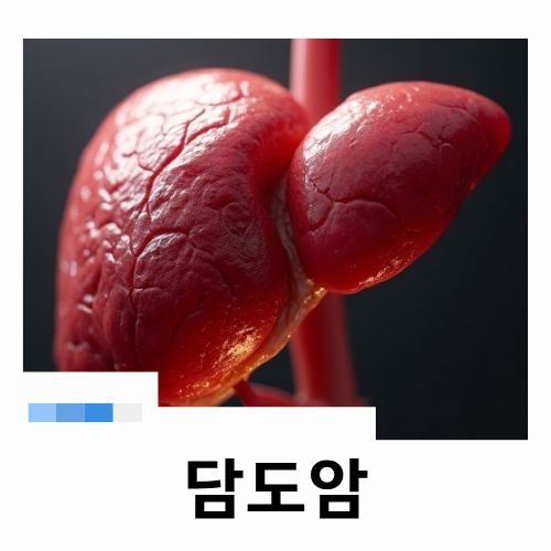 담도암 원인 증상 담관암 치료 방법