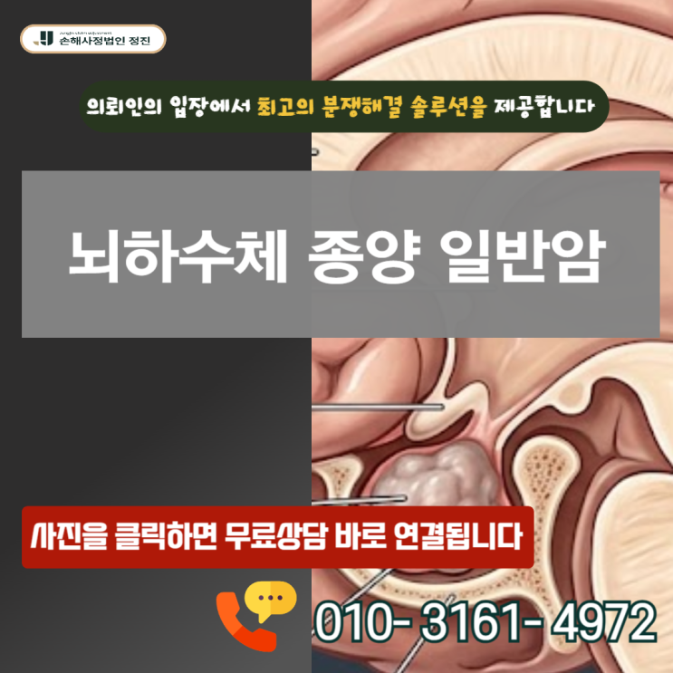 뇌하수체 종양 일반암 D35.2, 보험금 거절당해도 8천만 원 받는 방법