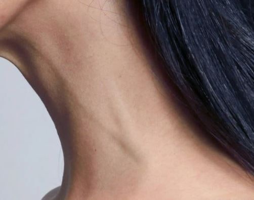 목 찔리는, 잘리는, 꺾이는, 없는 시체, 잘리는 걸 보는 꿈 해몽