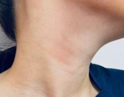 목 없는 사람, 나오는, 졸리는, 조르는, 목구멍 꿈 해몽