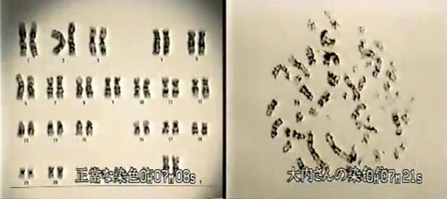  안락사가 필요한 이유 - 죽음 외에는 벗어날 수 없는 지옥의 고통이 실재하고, 누구나 그것을 경험하게 될 수 있기 때문입니다.