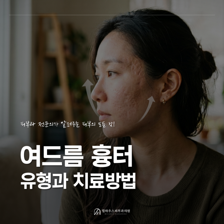  수원 여드름 패인 흉터,피부과 전문의가 알려주는 '새살 차오르는 원리'