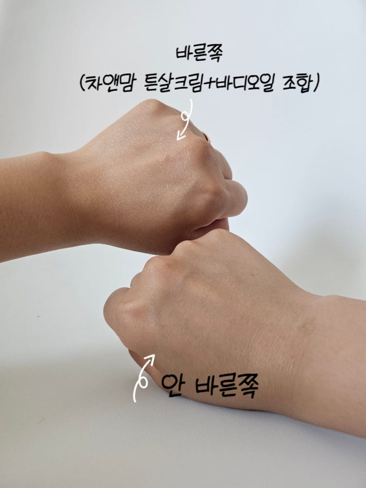  튼살 바디케어 차앤맘 마크제로 튼살크림 & 너리싱 바디오일 후기