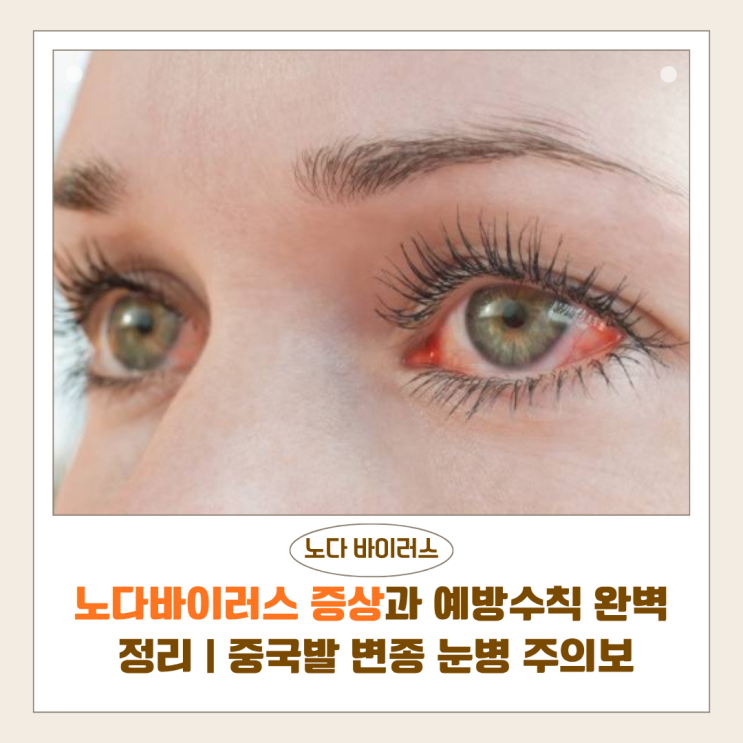  노다바이러스 증상과 예방수칙 완벽 정리 | 중국발 변종 눈병 주의보