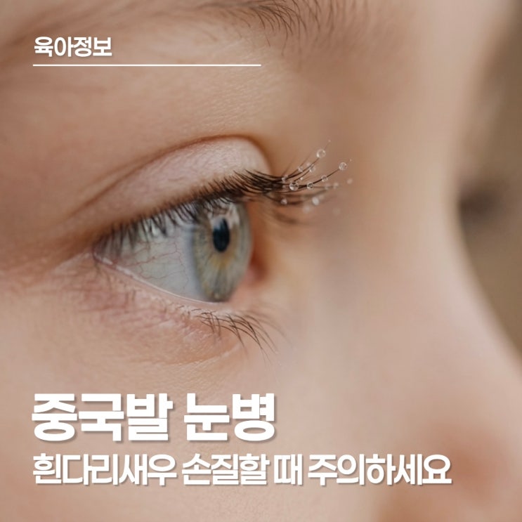  "새우 만질 때 조심하세요!" 실명 유발 중국 눈병 예방과 아이 위생 관리법