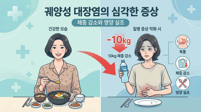 궤양성 대장염이란? 30대 환자 39% 급증, 이 증상 있으면 즉시 병원 가세요