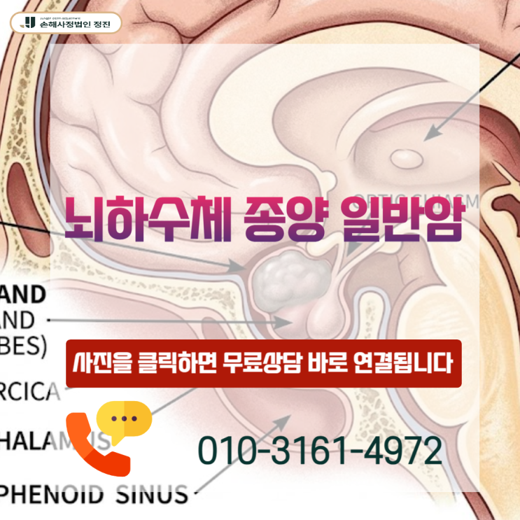  뇌하수체 종양 일반암, D35.2인데 0원? 5천만 원 전액 뒤집은 핵심 기준