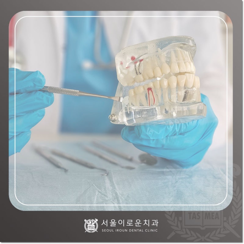 신경치료 후 식사 언제부터 해도 될까요?