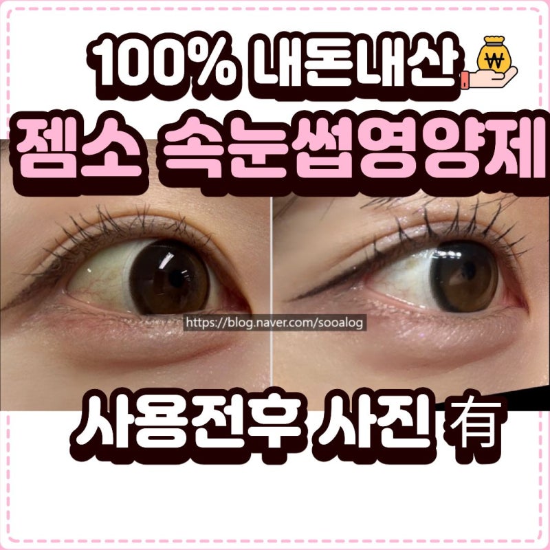 [내돈내산] 속눈썹영양제 내돈내산 후기 한달사용후기｜젬소효과｜부작용｜ 전후사....