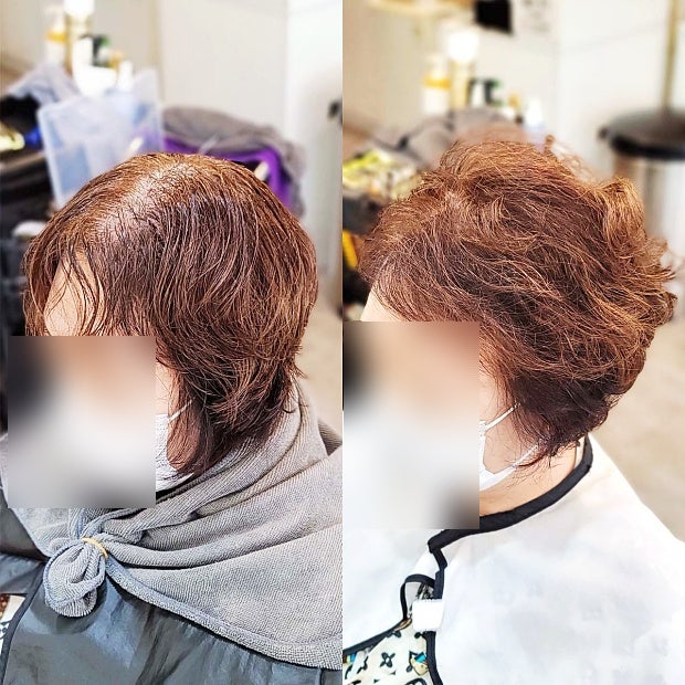  강남에서 모시고 온 어버이날 효도 선물, 휑한 정수리와 갈라지는 가르마도 링거펌으로 채워질까요?