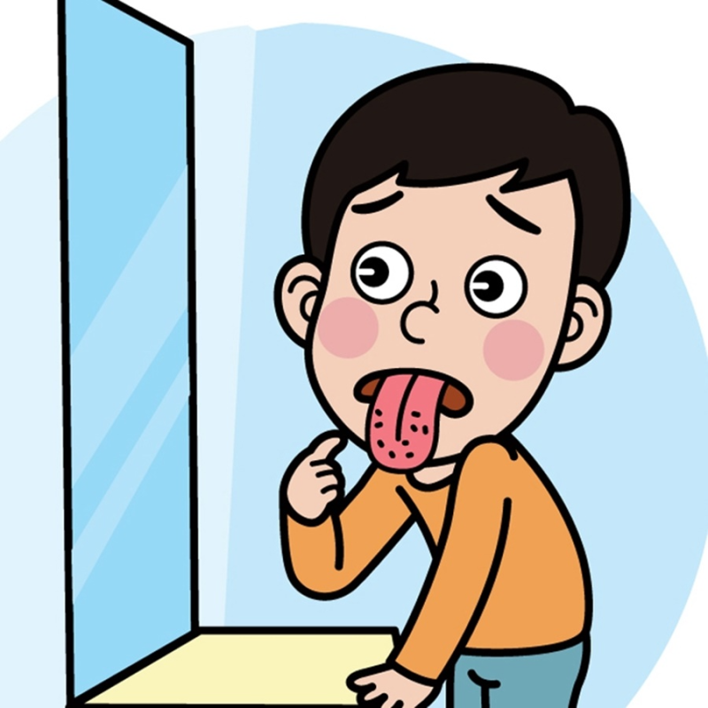 혓바늘 뽑기 하다가 병원에 갈 수도
