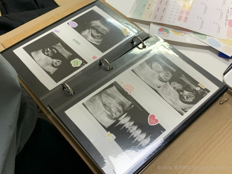  임신 10주 일상, 11주 증상 변화｜입덧 언제 끝날까? 1차 기형아 검사 태아보험 산후조리원