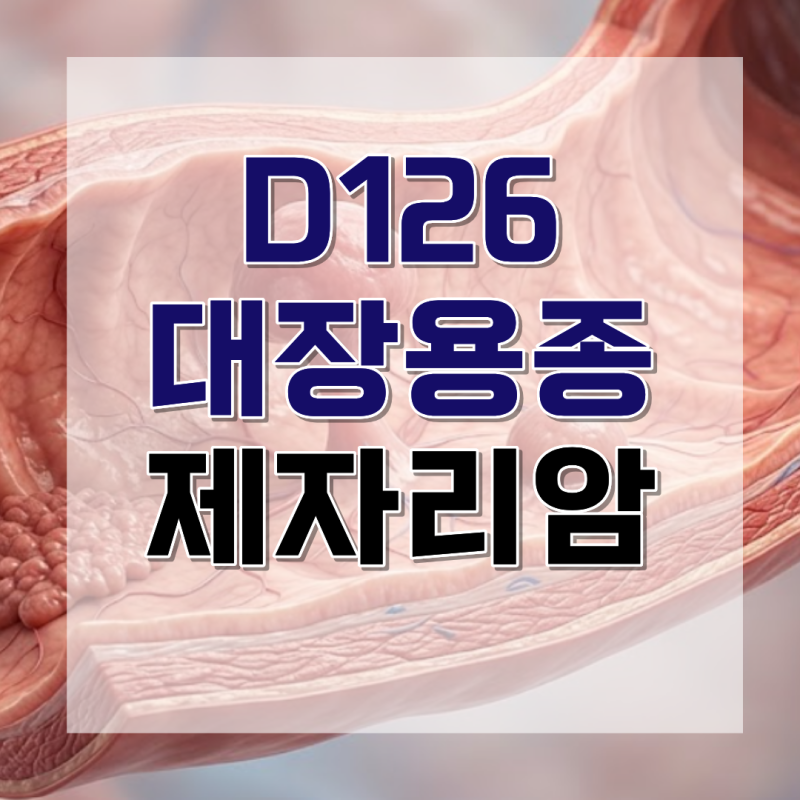 D126 대장용종 제자리암진단비, 양성종양 진단서로도 보상 가능한 의학적 기준