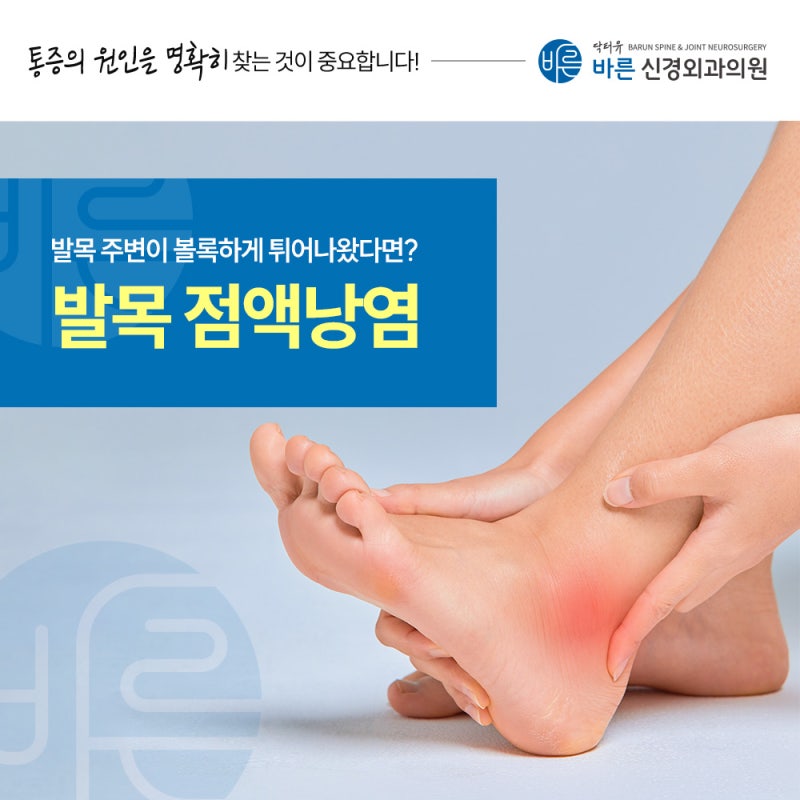 부산발목정형외과 발목점액낭염 발목이 이유 없이 붓는다면 의심해 보세요