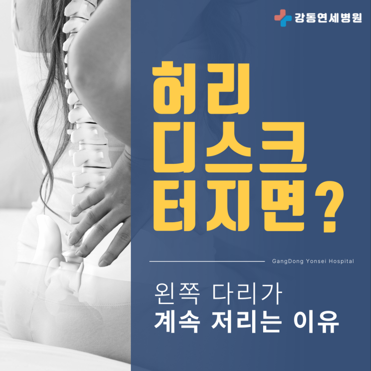  암사역 2번출구 정형외과 왼쪽 다리 쥐나는 이유, 허리디스크 터지면 나타나는 증상?