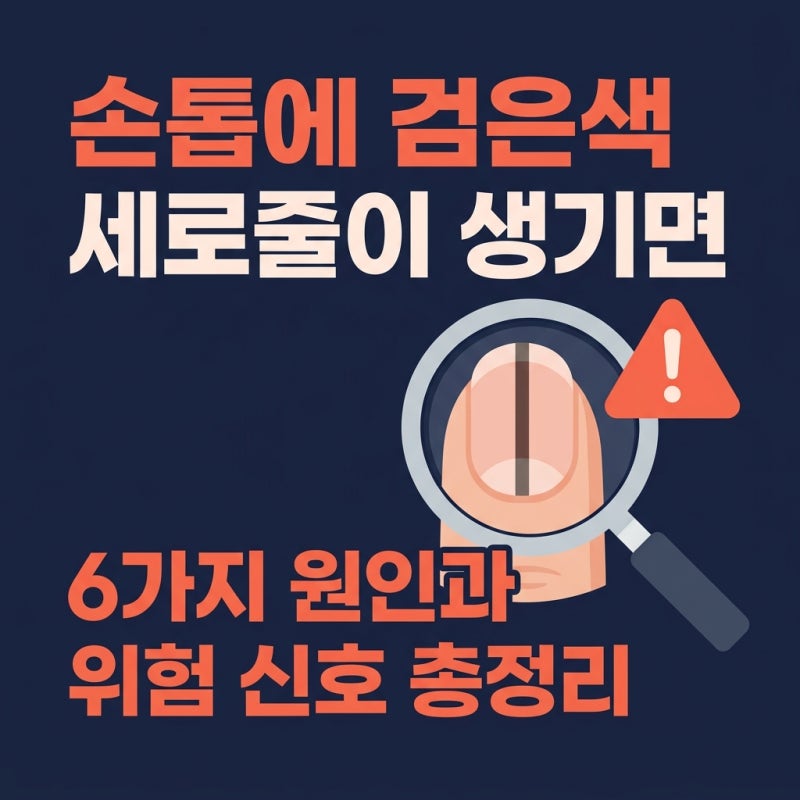 손톱에 검은세로줄이 생겼다면 — 원인 6가지와 병원 가야 할 위험 신호