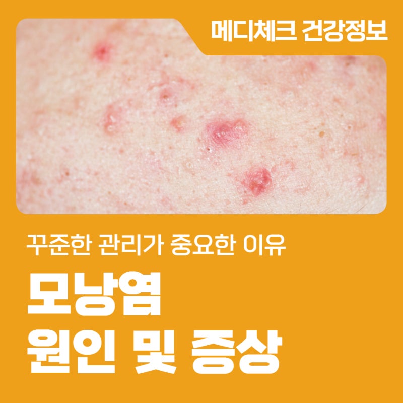 모낭염 원인 및 증상, 꾸준한 관리가 중요한 이유
