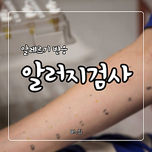 알러지 검사 알레르기 검사 병원 비용