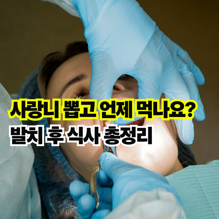  사랑니 발치 후 식사 가능한 시기와 추천하는 음식 주의사항 정리