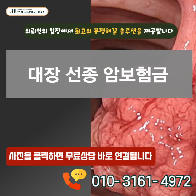  대장 선종 암보험금, D12인데 왜 누구는 0원이고 누구는 2천만 원일까?