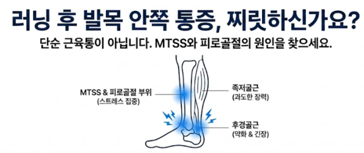  러닝 달릴때 발목 복숭아뼈 안쪽 통증 (MTSS 피로골절)