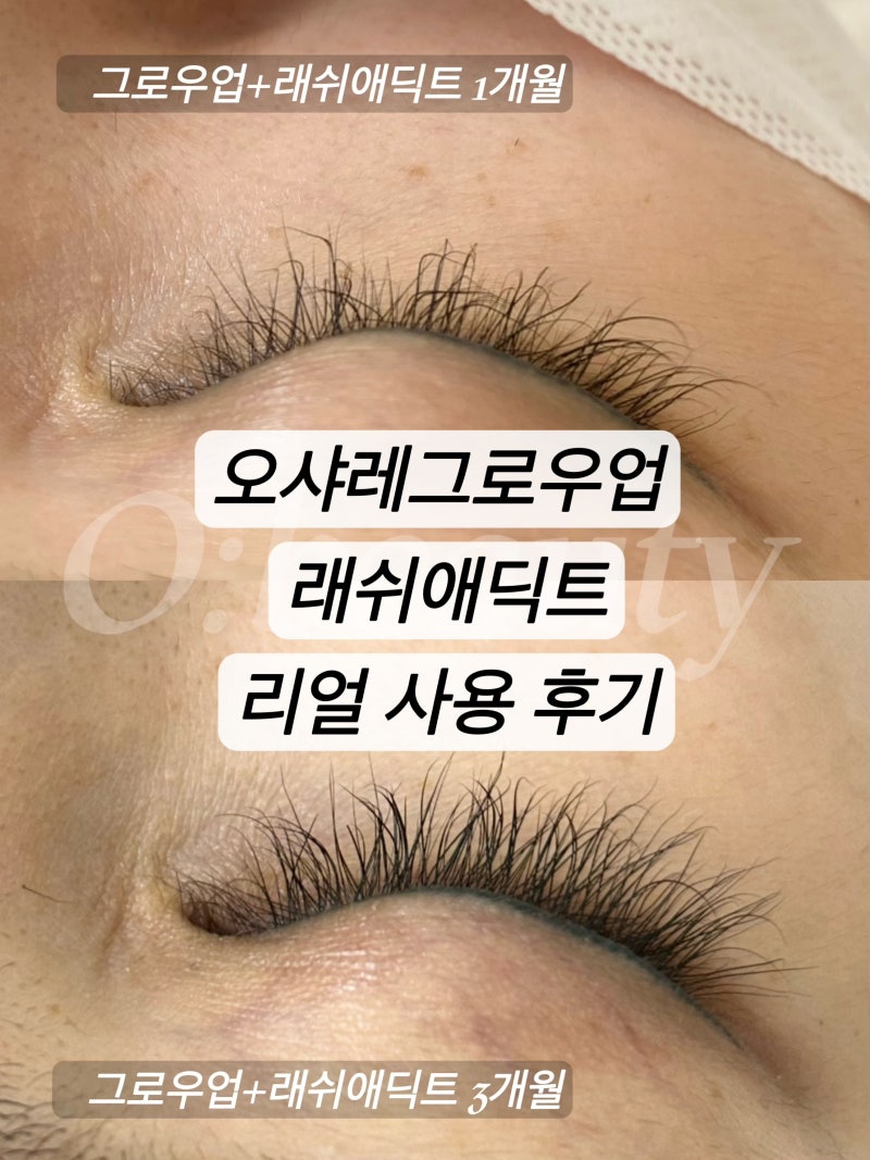 속눈썹영양제 추천 오샤레그로우업 래쉬애딕트