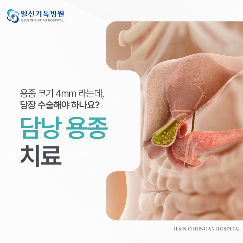 담낭절제수술 용종 크기 4mm 라는데 해야 하나요?