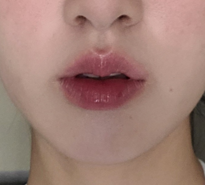롬앤 구순염 논란? 틴트 사용 후기 (진행 중 vs 완치 후 비교)