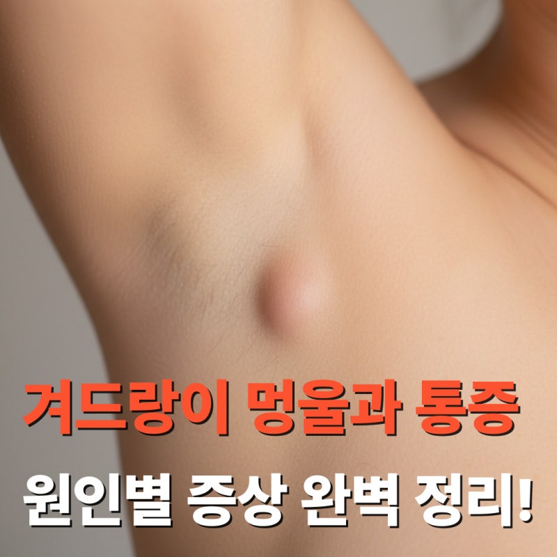 겨드랑이 멍울과 통증 혹시 부유방? 원인별 증상 완벽 정리