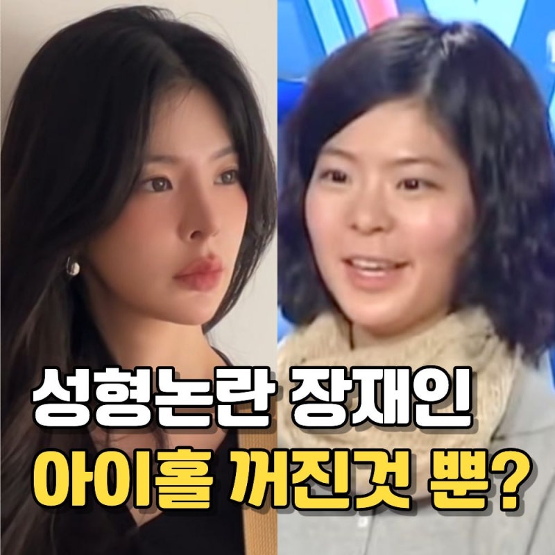 장재인, 성형인가? “최근 사진 진짜 못 알아봤다” 달라진 진짜 이유는?