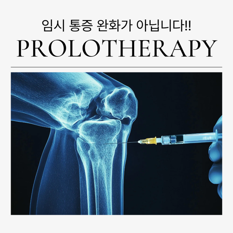  인대강화주사는 뼈주사와 다른 치료 방법입니다