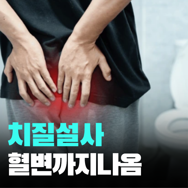 치질 설사 혈변 원인 위험 신호 3가지