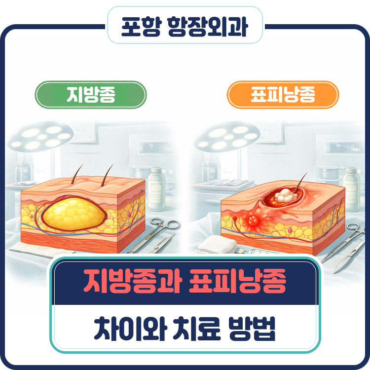 포항 지방종과 표피낭종, 헷갈리리는 피부 혹의 차이와 치료 방법