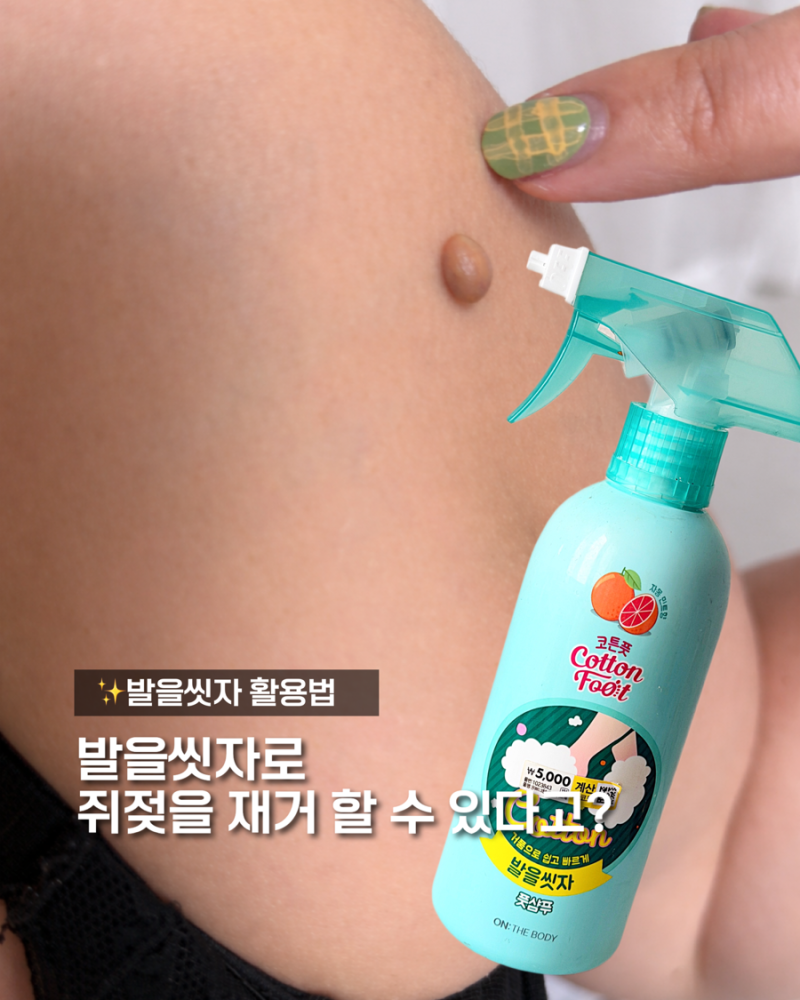 발을씻자 쥐젖 효과 가능할까 원리부터 부작용까지 사용전 체크