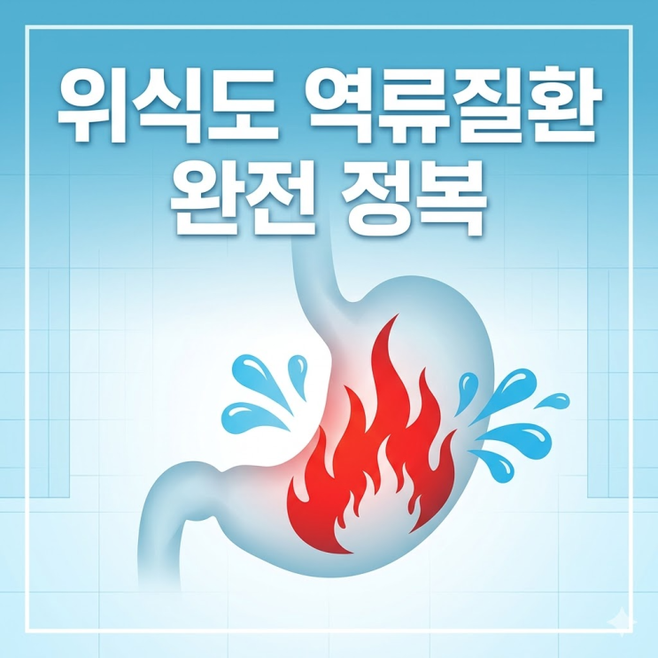 역류성 식도염 증상, 단순한 속쓰림일까? 목 이물감과 마른 기침 방치하면 위암까지?