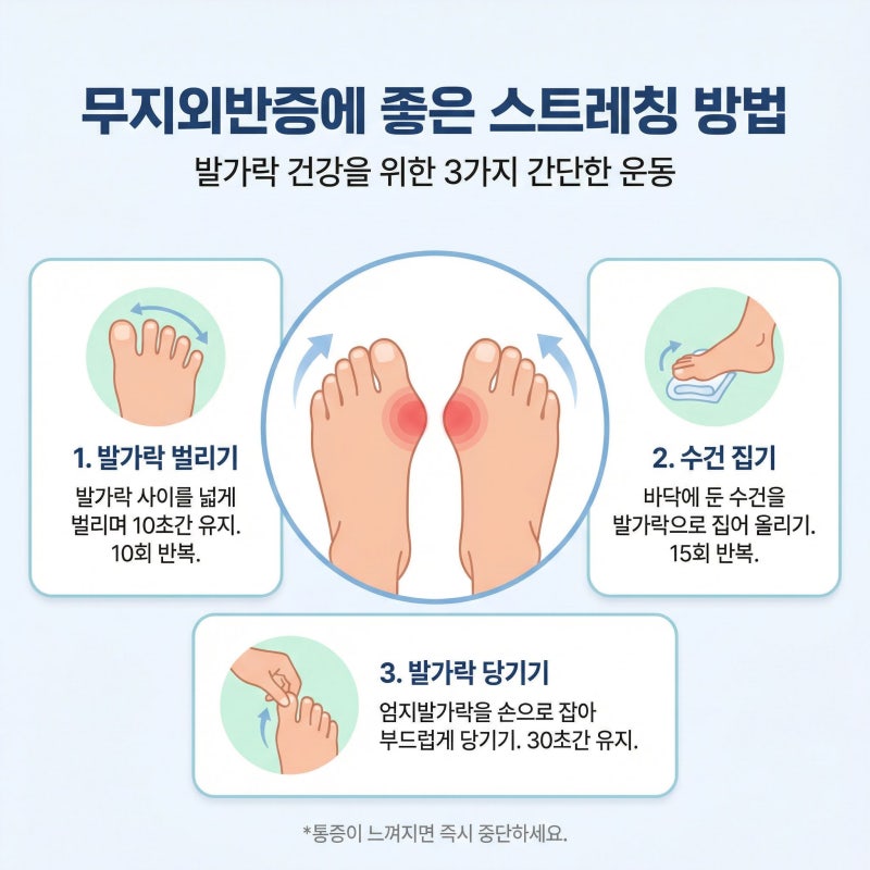 무지외반증에 좋은 스트레칭 방법 알려주세요
