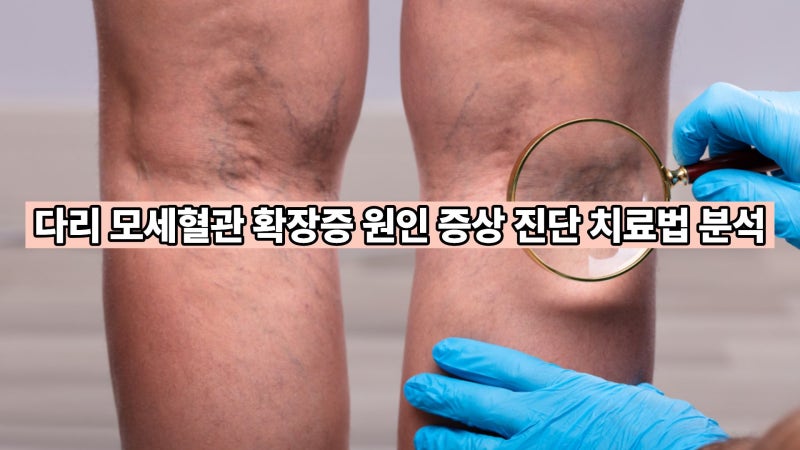 다리 모세혈관확장증 원인 증상 진단 치료법 심층 분석