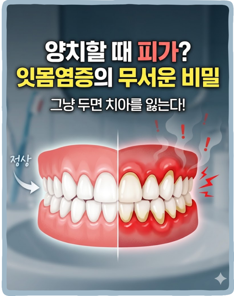 잇몸염증, 통증 그냥 두면 치아를 잃는 이유 치주염 치은염