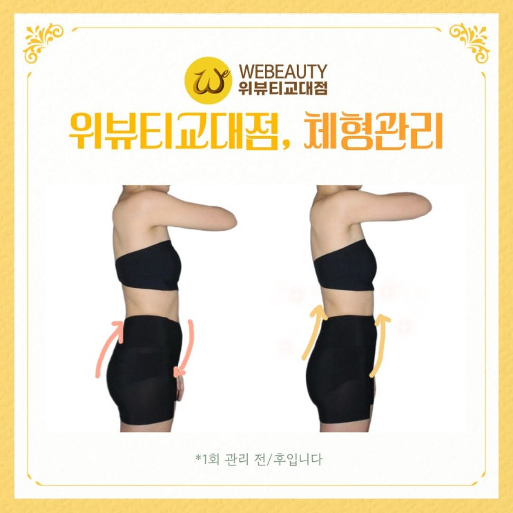  교대체형관리실] 골반 전방경사가 아랫배볼록과 몸에 미치는 영향