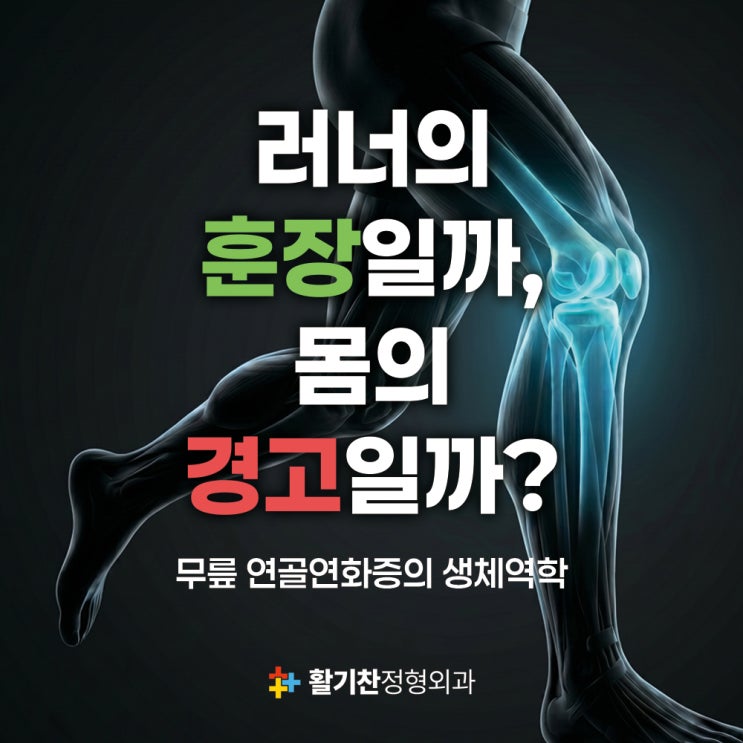  오운완보다 중요한 무릎 건강, 연골연화증 예방 가이드