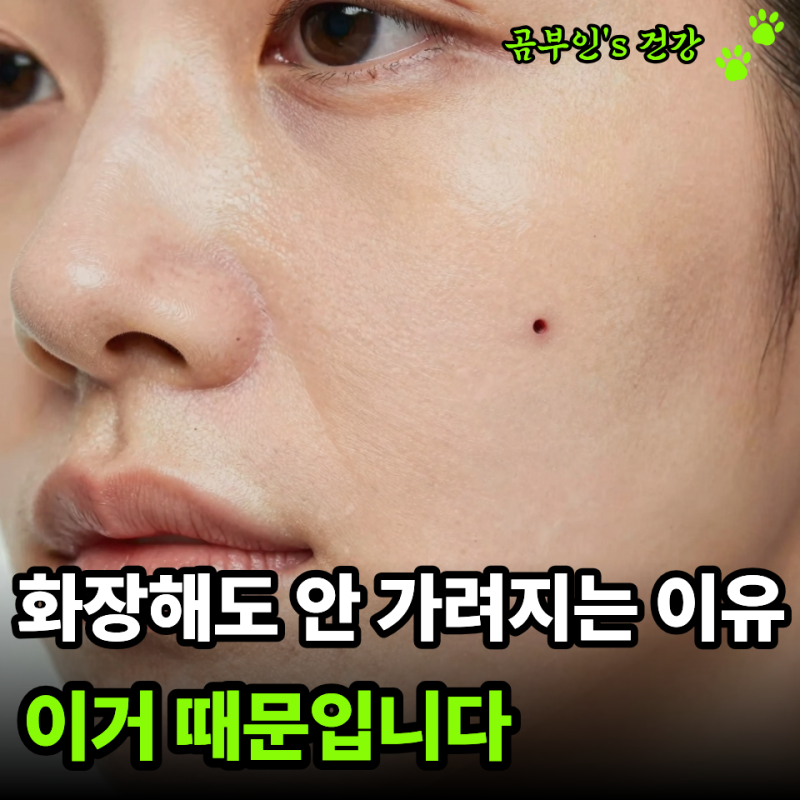 아무 병원이나 갔다가 후회… 위너확장구멍 수술, 꼭 따져야 할 기준