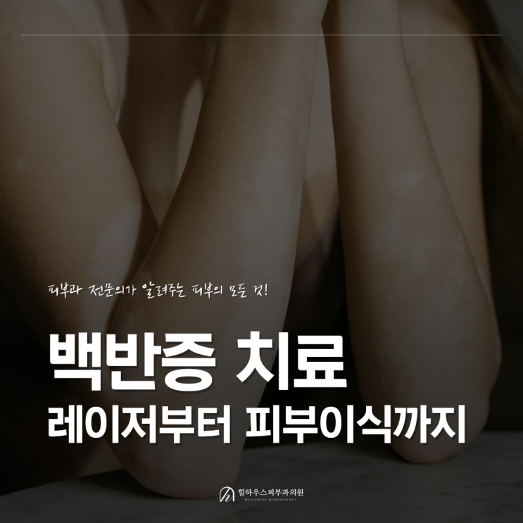  수원 백반증 치료: 원인부터 엑시머 레이저, 피부이식술까지 총정리