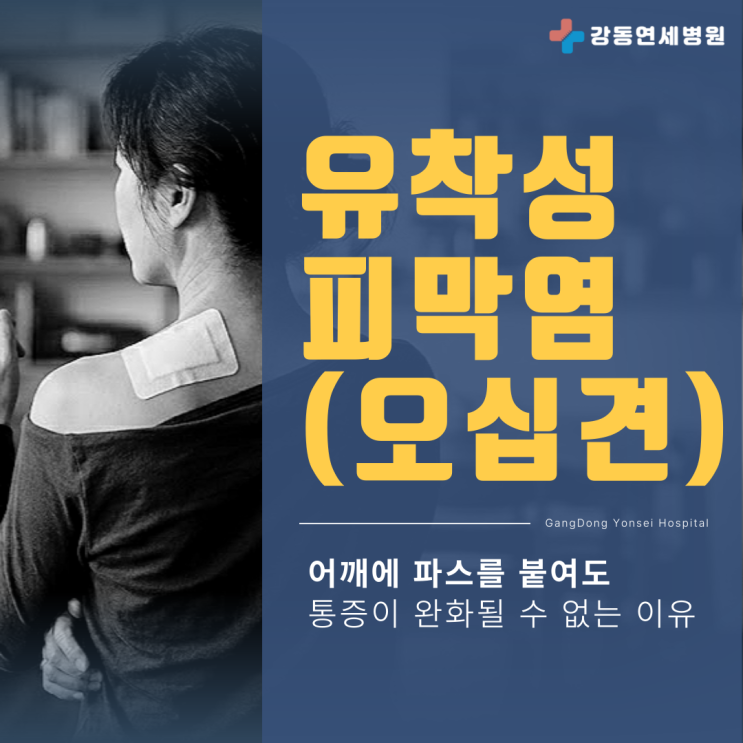  암사동도수치료 정형외과 유착성피막염(오십견), 어깨 파스 붙이는 위치보다 중요한 '이것'?