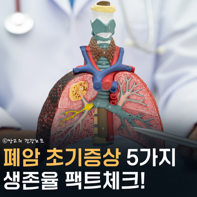 놓치기 쉬운 폐암 초기증상 5가지와 생존율, 예방법 | 이 글 지나치지 마세요!