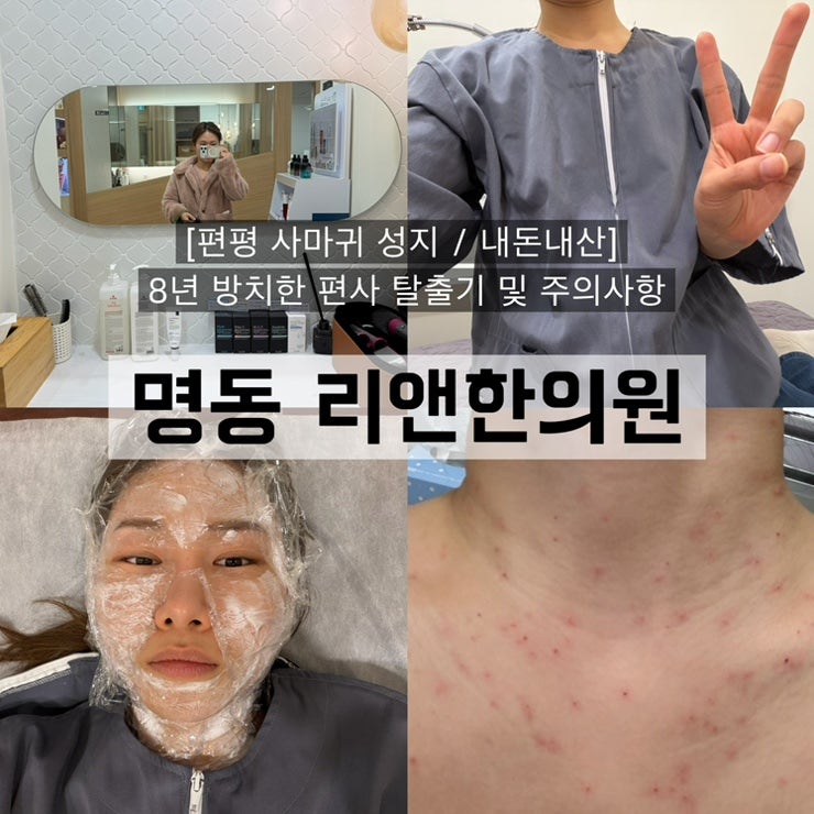 [편평 사마귀 성지 / 내돈내산] 8년 방치한 편사 탈출기 및 주의사항 (ft.명동 리앤한의원)