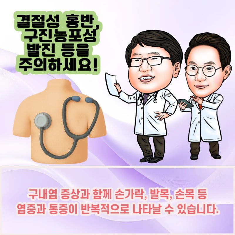 베체트병 전염 걱정되시나요? 전염되지 않는 면역 질환입니다