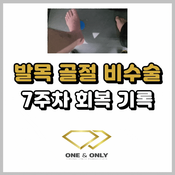 발목 골절 비수술 7주차 기록 : 2주 깁스를 더 하라고요?
