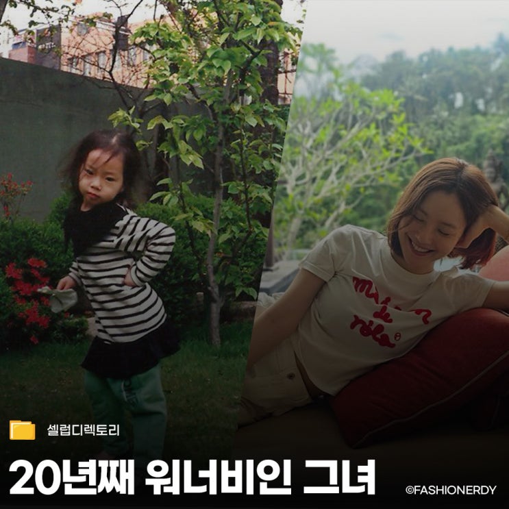  얼굴에 붕대 감고 오디션 봤던 신인 배우, 여전히 워너비인 근황